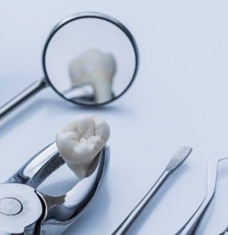 Instrumental de cirugía oral con una pieza extraída
