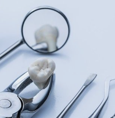 Implante dental