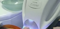 Lámpara Philips Zoom! aplicando luz LED durante un blanqueamiento en la consulta